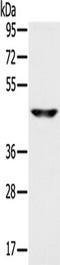 Monocarboxylate transporter 3 antibody, TA351676, Origene, Western Blot image 