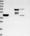 N-Glycanase 1 antibody, NBP1-83792, Novus Biologicals, Western Blot image 