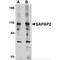 DLG Associated Protein 2 antibody, MBS151501, MyBioSource, Western Blot image 