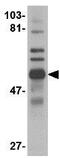 Tripartite motif-containing protein 30 antibody, GTX85386, GeneTex, Western Blot image 