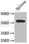 Zinc Finger DHHC-Type Containing 1 antibody, CSB-PA837848LA01HU, Cusabio, Western Blot image 