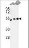 Aldh3 antibody, LS-C156260, Lifespan Biosciences, Western Blot image 