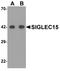 Sialic Acid Binding Ig Like Lectin 15 antibody, A14323, Boster Biological Technology, Western Blot image 