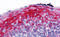 Zinc Finger MYM-Type Containing 4 antibody, 6139, ProSci, Immunohistochemistry frozen image 