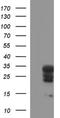 HscB Mitochondrial Iron-Sulfur Cluster Cochaperone antibody, NBP2-46506, Novus Biologicals, Western Blot image 