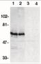 BCL2 Associated Athanogene 4 antibody, NBP1-76897, Novus Biologicals, Western Blot image 