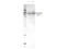 MORC Family CW-Type Zinc Finger 3 antibody, A06075-1, Boster Biological Technology, Western Blot image 