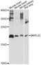 Mitochondrial Ribosomal Protein L22 antibody, LS-C749585, Lifespan Biosciences, Western Blot image 