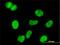 Minichromosome Maintenance Complex Component 3 antibody, H00004172-M03, Novus Biologicals, Immunocytochemistry image 