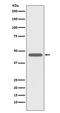 CD83 Molecule antibody, M01777-1, Boster Biological Technology, Western Blot image 