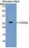 Leukocyte Immunoglobulin Like Receptor B3 antibody, MBS2013062, MyBioSource, Western Blot image 