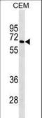 BLNK antibody, LS-C159177, Lifespan Biosciences, Western Blot image 
