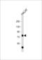Tumor Protein P63 antibody, 57-384, ProSci, Western Blot image 