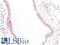 Filaggrin antibody, LS-B13715, Lifespan Biosciences, Immunohistochemistry paraffin image 