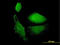Vesicle-associated membrane protein 1 antibody, LS-C133460, Lifespan Biosciences, Immunofluorescence image 