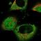 Neisseria gonorrhoeae MOMP antibody, NBP1-81203, Novus Biologicals, Immunocytochemistry image 