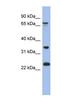 TBC1 Domain Family Member 25 antibody, NBP1-56840, Novus Biologicals, Western Blot image 