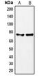 GRB2-associated-binding protein 2 antibody, LS-C353207, Lifespan Biosciences, Western Blot image 