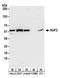 Kinetochore protein Nuf2 antibody, A304-319A, Bethyl Labs, Western Blot image 