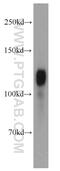 Amphiphysin antibody, 13379-1-AP, Proteintech Group, Western Blot image 