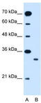 Mitochondrial glutamate carrier 1 antibody, TA333671, Origene, Western Blot image 