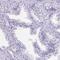Leucine Rich Repeat Containing 18 antibody, PA5-58714, Invitrogen Antibodies, Immunohistochemistry paraffin image 