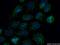 Mitochondrial Ribosomal Protein L27 antibody, 14765-1-AP, Proteintech Group, Immunofluorescence image 