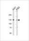 Polypeptide N-Acetylgalactosaminyltransferase 5 antibody, MBS9209429, MyBioSource, Western Blot image 