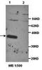 TNF Receptor Superfamily Member 11b antibody, orb77274, Biorbyt, Western Blot image 