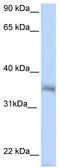 Protein HEXIM2 antibody, TA343990, Origene, Western Blot image 