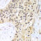 26S protease regulatory subunit 8 antibody, LS-C335163, Lifespan Biosciences, Immunohistochemistry paraffin image 