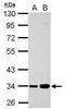 Poly(ADP-Ribose) Polymerase Family Member 16 antibody, PA5-32130, Invitrogen Antibodies, Western Blot image 