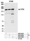 Glutamyl-Prolyl-TRNA Synthetase antibody, A303-959A, Bethyl Labs, Immunoprecipitation image 
