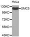 Structural Maintenance Of Chromosomes 5 antibody, abx001871, Abbexa, Western Blot image 