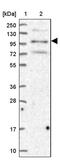 Zinc Finger BED-Type Containing 4 antibody, PA5-60980, Invitrogen Antibodies, Western Blot image 