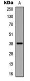 Ubiquitin Conjugating Enzyme E2 U antibody, orb234977, Biorbyt, Western Blot image 