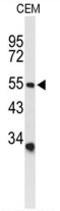 Amiloride-sensitive cation channel 2, neuronal antibody, AP50044PU-N, Origene, Western Blot image 