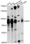 Sorting nexin-9 antibody, A0977, ABclonal Technology, Western Blot image 
