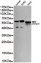 SMAD Family Member 5 antibody, TA347048, Origene, Western Blot image 