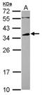 Low affinity immunoglobulin gamma Fc region receptor II-b antibody, NBP2-14904, Novus Biologicals, Western Blot image 