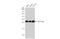 Tyrosine 3-Monooxygenase/Tryptophan 5-Monooxygenase Activation Protein Eta antibody, GTX113577, GeneTex, Western Blot image 