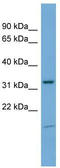 Neuronal Growth Regulator 1 antibody, TA331416, Origene, Western Blot image 