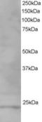 VPS28 Subunit Of ESCRT-I antibody, EB06276, Everest Biotech, Western Blot image 