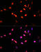 Lysine-specific demethylase 6B antibody, 14-618, ProSci, Immunofluorescence image 