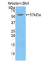 Glucosylceramidase Beta antibody, LS-C302732, Lifespan Biosciences, Western Blot image 