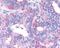 Vasoactive Intestinal Peptide Receptor 2 antibody, NLS1305, Novus Biologicals, Immunohistochemistry paraffin image 