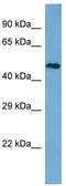 RNA Binding Fox-1 Homolog 2 antibody, TA329611, Origene, Western Blot image 