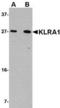 T-cell surface glycoprotein YE1/48 antibody, TA306710, Origene, Western Blot image 