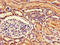 Nudix Hydrolase 21 antibody, A63058-100, Epigentek, Immunohistochemistry paraffin image 