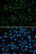 Androgen Receptor antibody, A2053, ABclonal Technology, Immunofluorescence image 